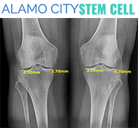 Alamo City Stem Cell