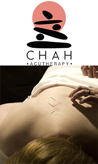 ChahAcu Therapy