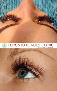 Toronto Beauty Clinic
