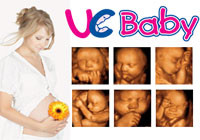 UC Baby 3D/4D Ultrasound